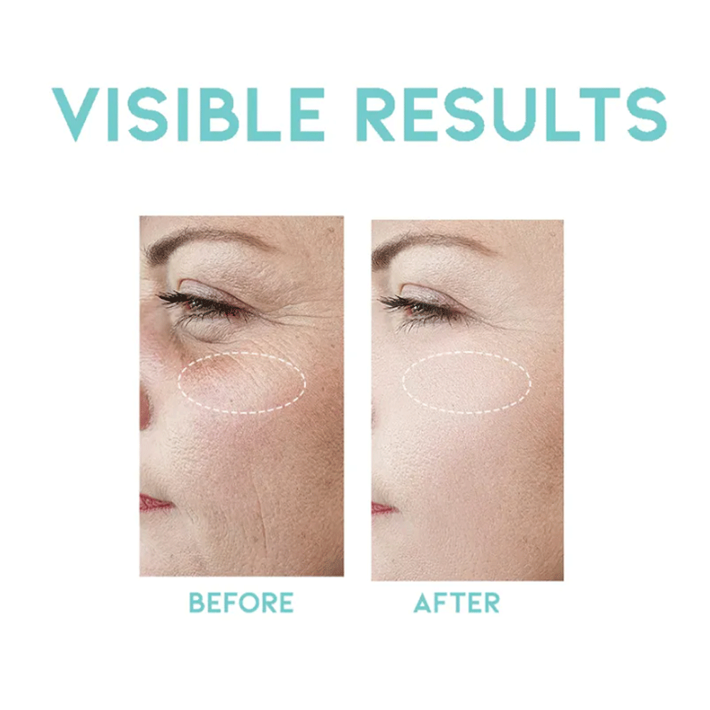OOTD Wrinkle Lift Retinol Serum 50ml