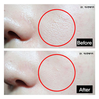 TOSOWOONG Platinum Miracle Pore Tightening Pack 150ml