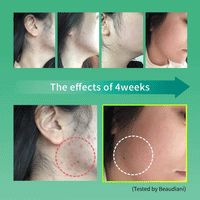BEAUDIANI Cica Ampoule Mask 100 pads