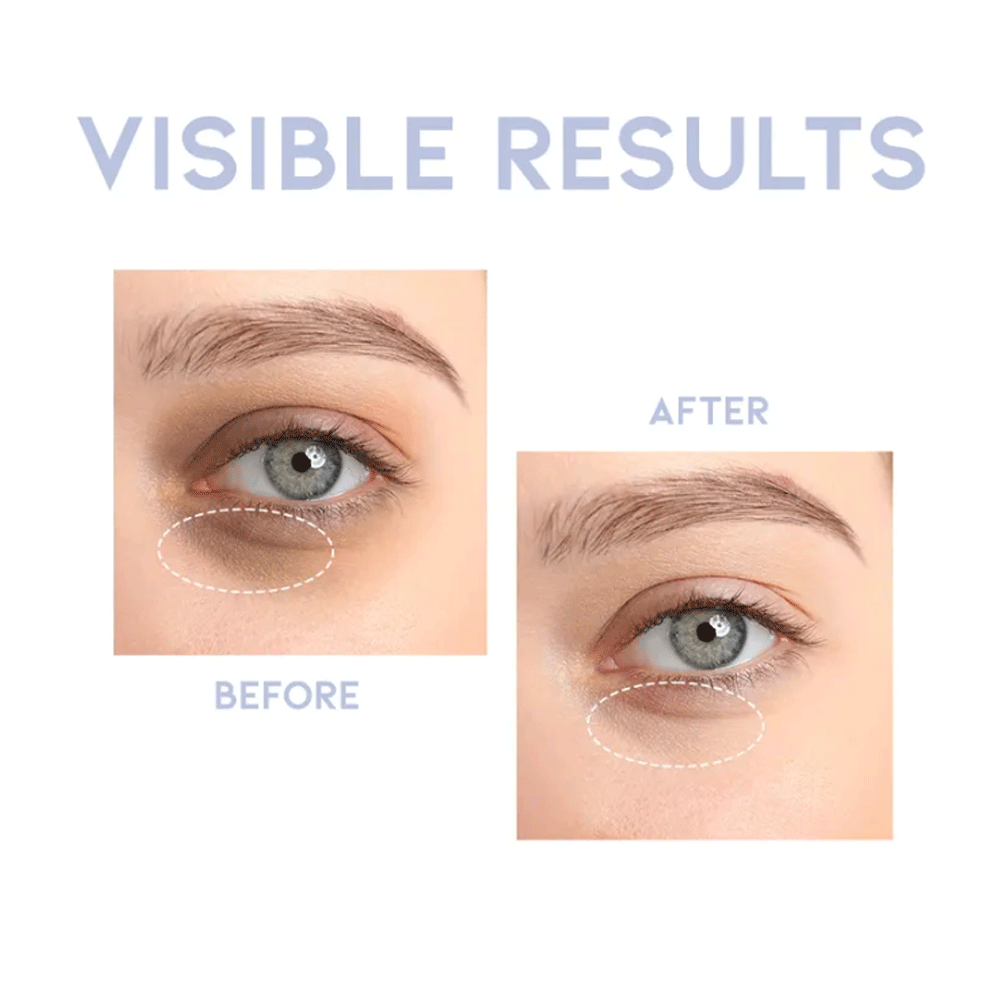OOTD Intensive Eye Serum A.M 30g