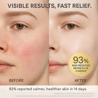 GONIM Skin Defense Advanced Cream 50ml
