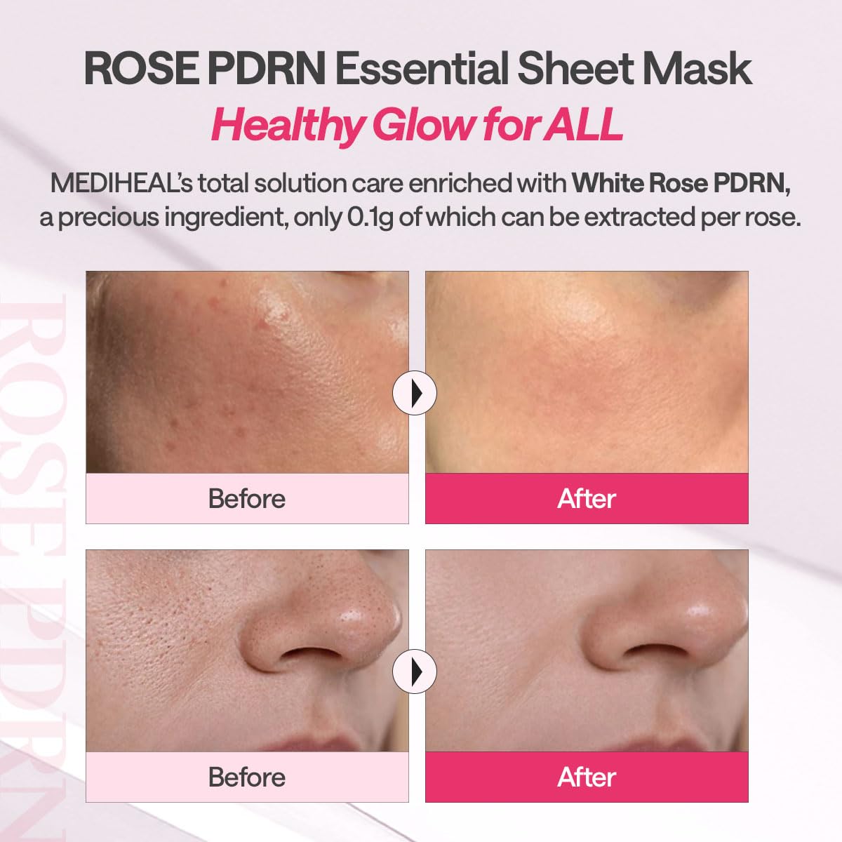 MEDIHEAL British White Rose PDRN Essential Mask Sheet Bio 10ea