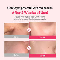 Re:dence Tone & Spot Corrector Ampoule 30ml