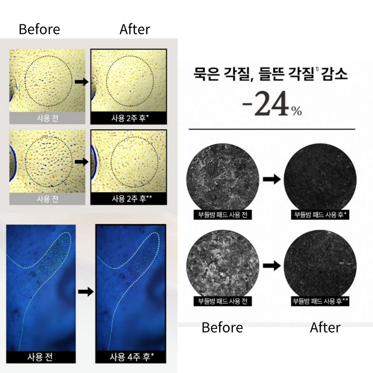 HANYUL Chestnut Shell Pore-Tight Pads 150ml 60EA