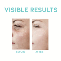 OOTD Wrinkle Lift Retinol Serum 50ml