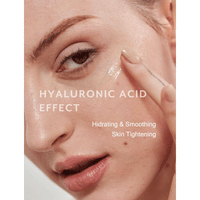 MIZON Hyaluronic Acid 100 30ml