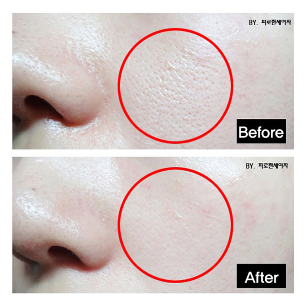 TOSOWOONG Platinum Miracle Pore Tightening Pack 150ml