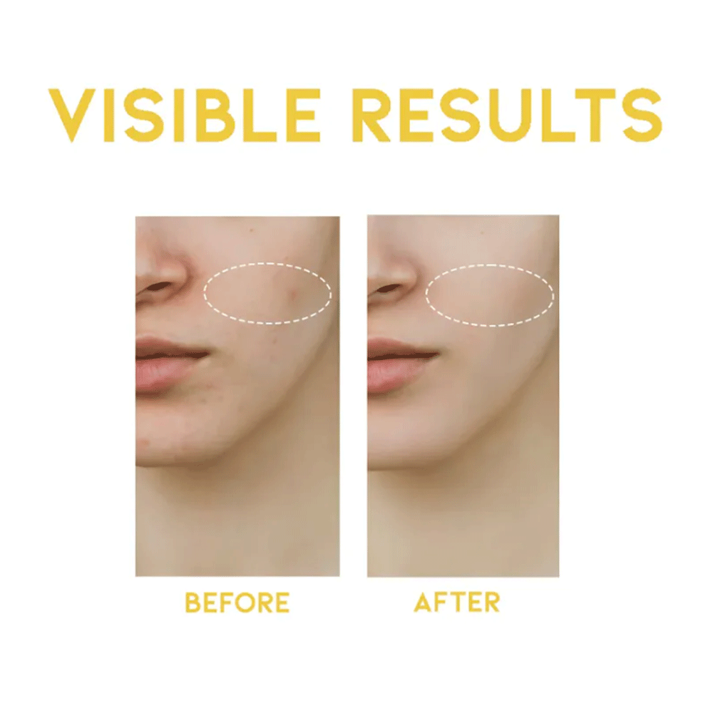 OOTD Dark Spot Vitamin C Serum 50ml