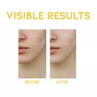 OOTD Dark Spot Vitamin C Serum 50ml