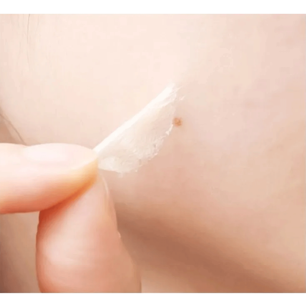 CELLBN Blemish Spot Cream & Black Spot Patch Set