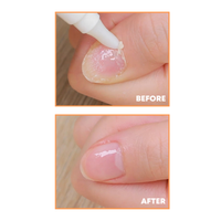 delyvely Nail Healer Pen 2ml