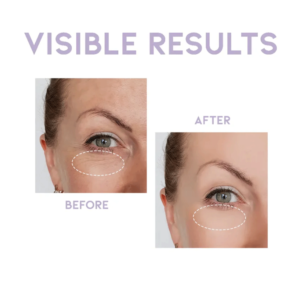 OOTD Overnight Eye Cream P.M 25g