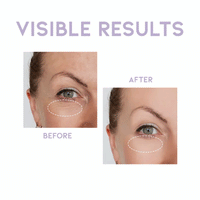 OOTD Overnight Eye Cream P.M 25g