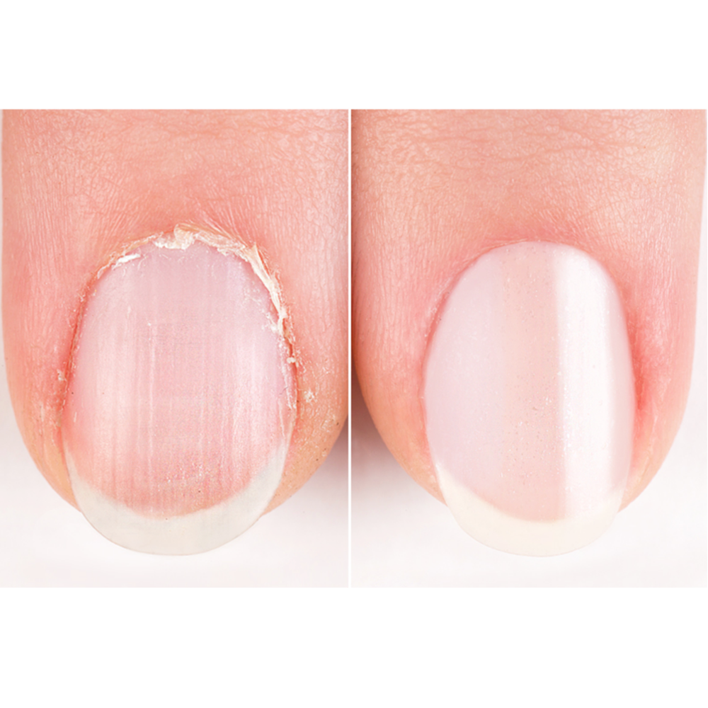 delyvely Nail Healer Pen 2ml