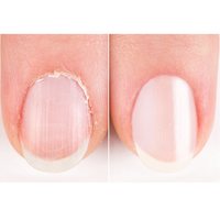 delyvely Nail Healer Pen 2ml