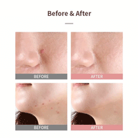 MIZON Good Bye Blemish Pink Spot 19ml