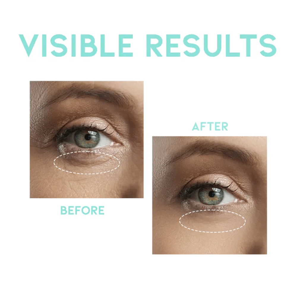 OOTD Wrinkle Lift Eye Serum 30g