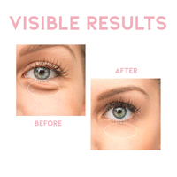 OOTD Depuff Eye Serum 30g