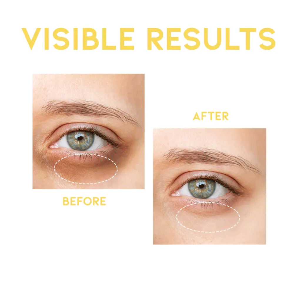 OOTD Dark Circle Eye Serum 30g