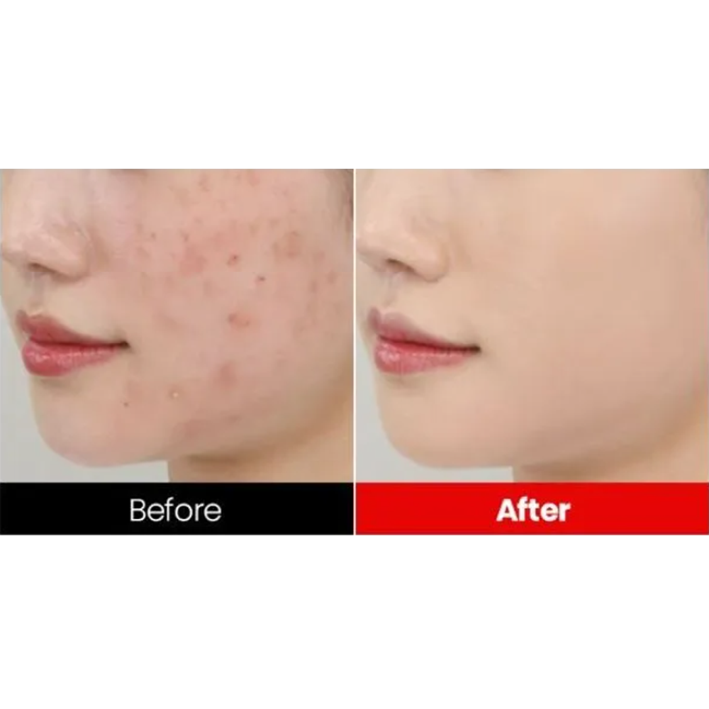Dr.want Red Concealer 32ml