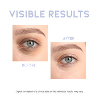OOTD Intensive Eye Serum 30g