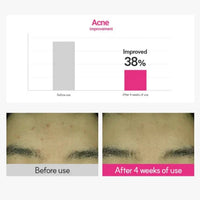 ROVECTIN Cica Care Blemish Clearing Cream 50ml