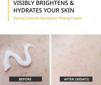 FORETDERM. Derma Intense Vita-Niacin Toning Cream 20ml