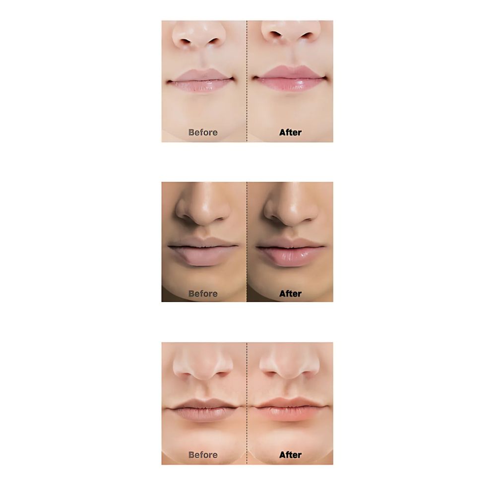 FORMENT Lip Balm 4.4g (2 options to choose)