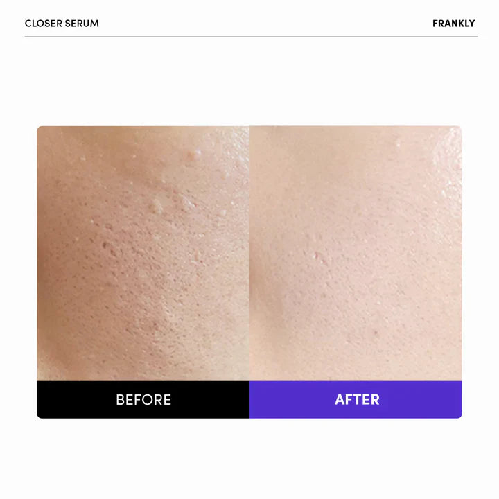 FRANKLY Closer Serum 30ml