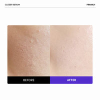 FRANKLY Closer Serum 30ml