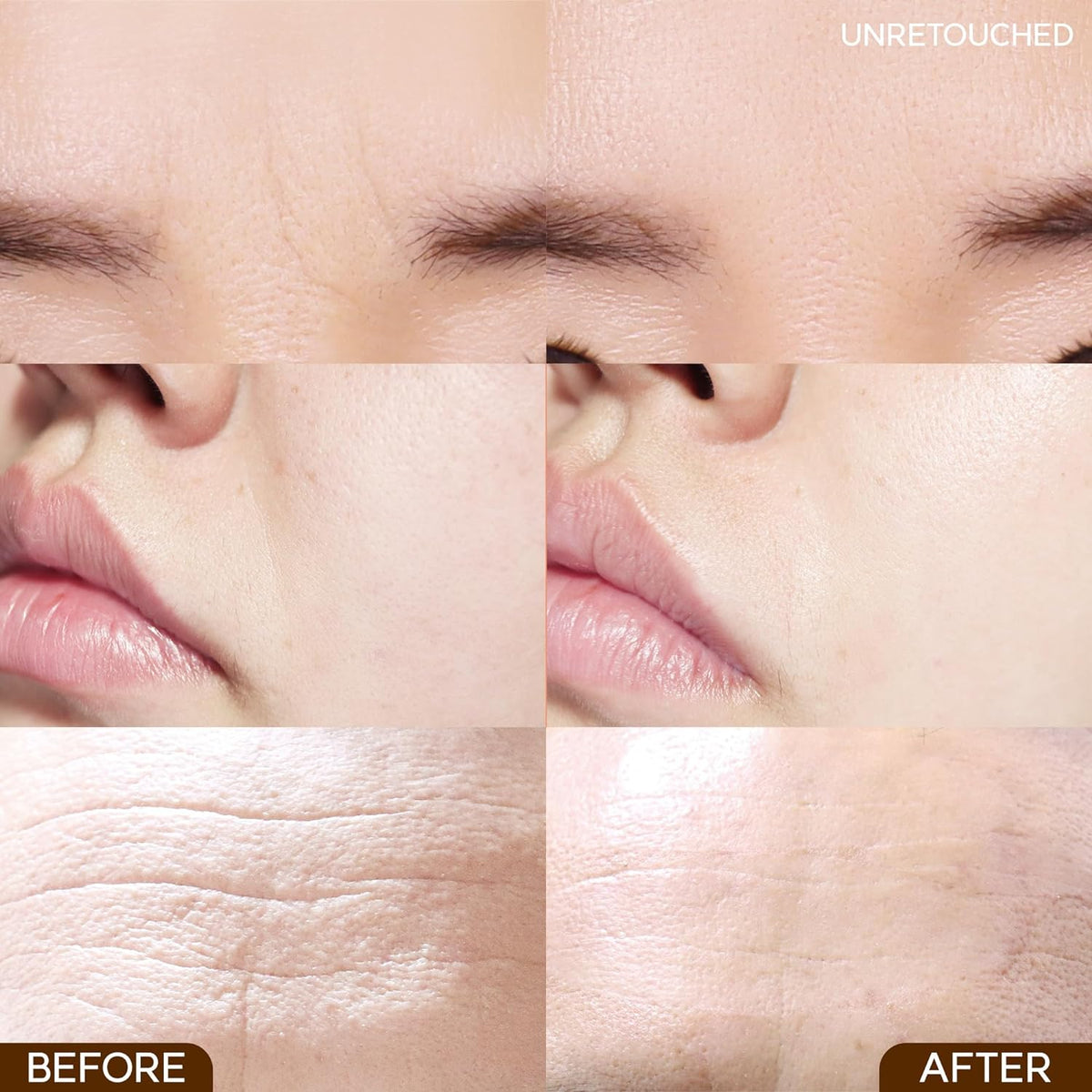 MARSHIQUE Wrinkle Repair Patch For Between Brows 33P