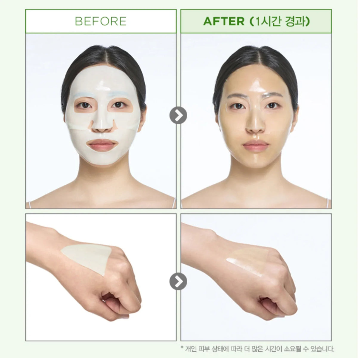 onoma Redness Reliever Tea Tree Calming Gel Mask Set (4+1)